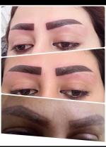 میکروپیگمنتیشن تاتو صورت و بدن